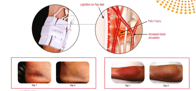 Recovery & Recuperation Technology